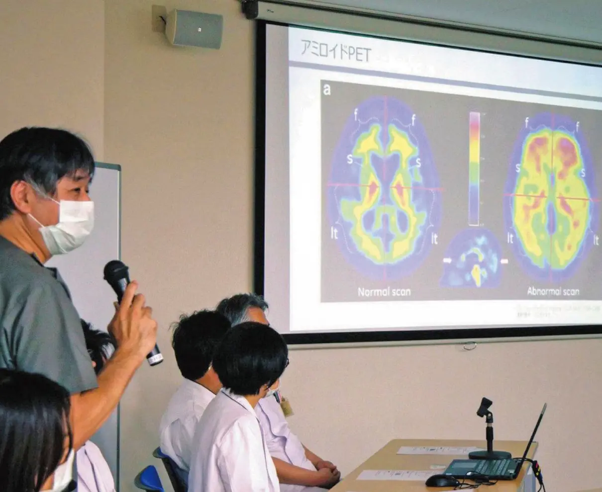 アルツハイマー病新薬投与検査へ　県済生会病院、条件満たせば開始